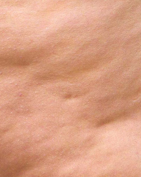 OESTROGEN CONNECTION