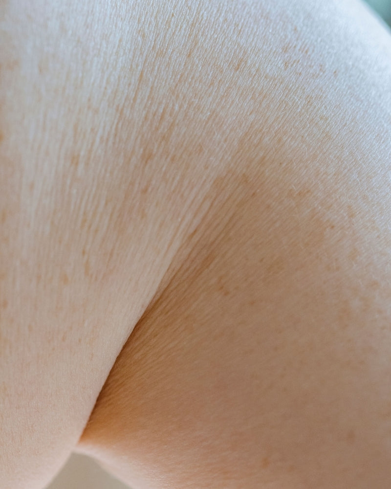 crepey skin