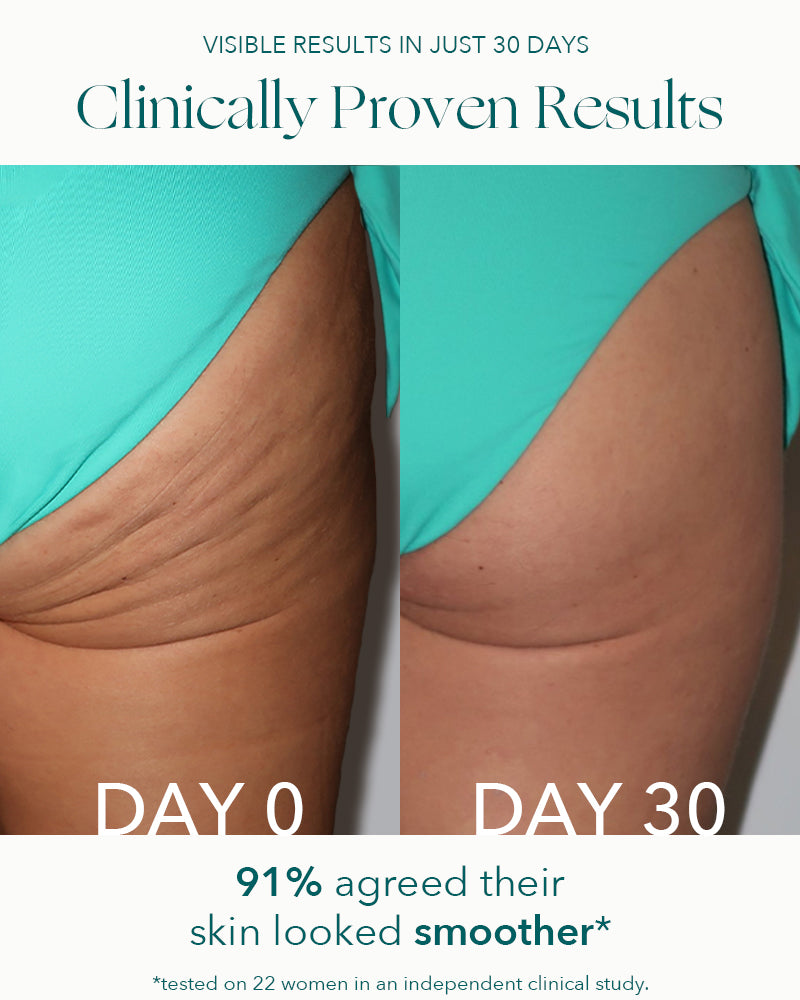 90 Day Cellu-Lite Set