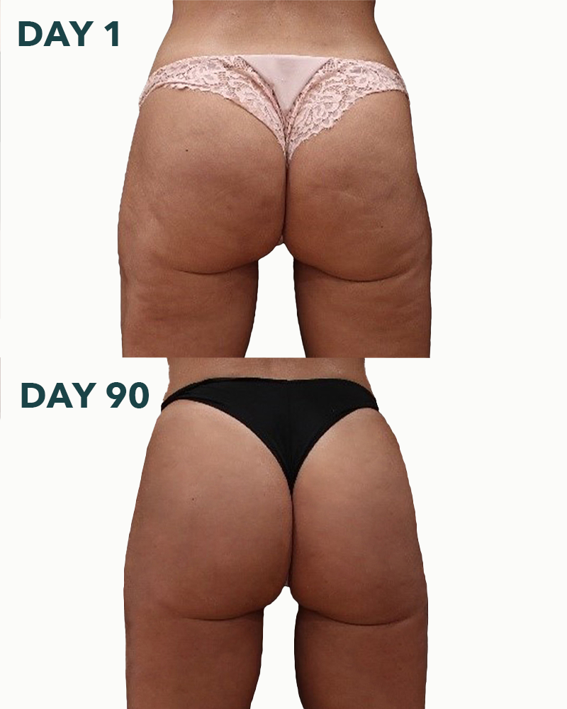 Peach-Lite - Bum Cream