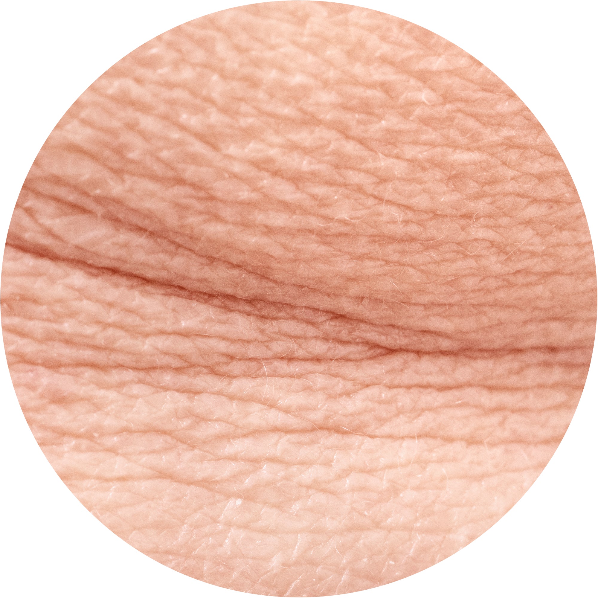 aging cause of cellulite