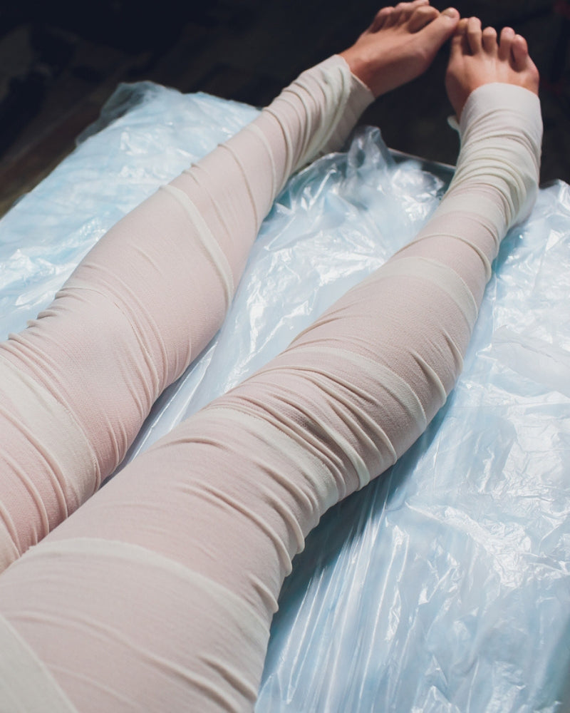lymphoedema