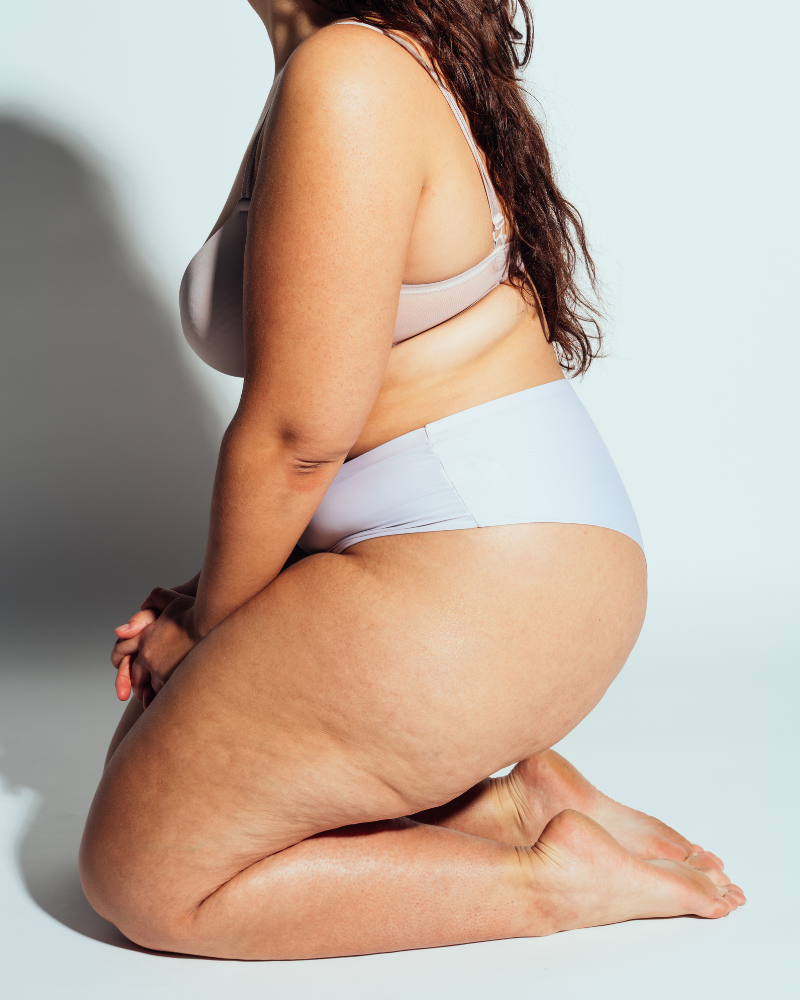 Fascia and Cellulite