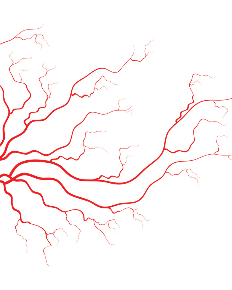 spider veins and varicose veins